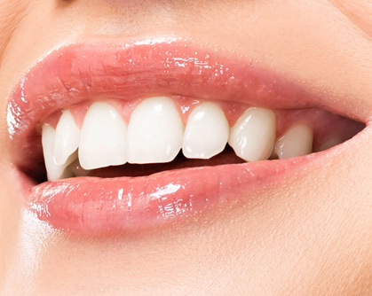 Teeth Whitening: What Works, What Doesn’t
