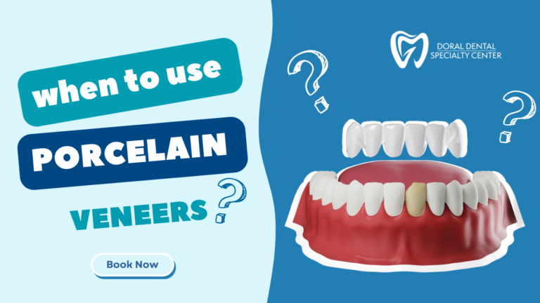 Doral Dental Specialty Center -When to use Porcelain Veneers
