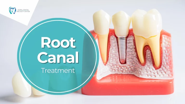 Your Expert Root Canal Specialist in Doral, FL